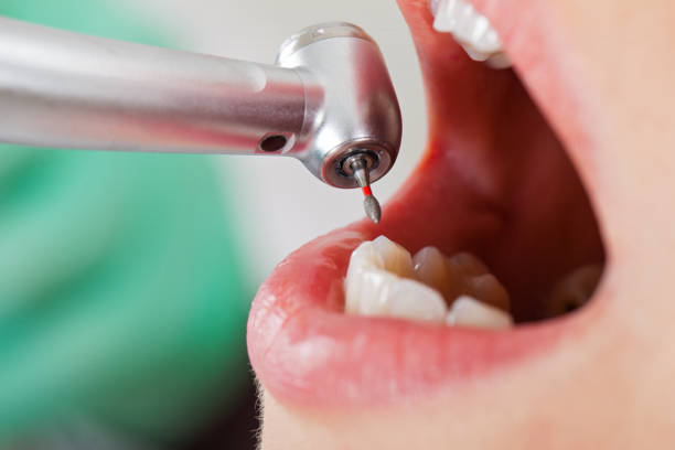 Best Weekend Emergency Dentist in Valdese, NC
